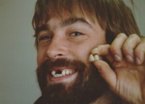 a man with a beard holding his two front teeth in his hand,